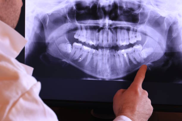 Best Tooth Infection Emergency Dentist  in Gladstone, MI