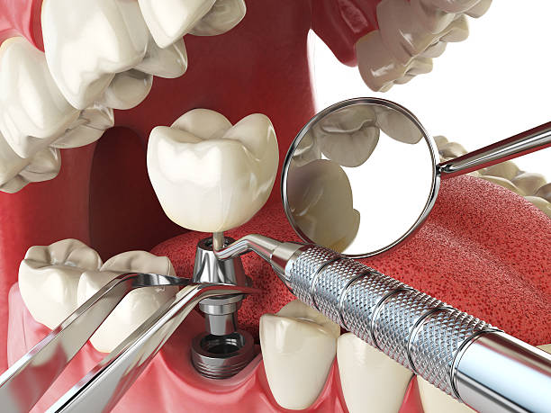 Best Emergency Tooth Extraction  in Gladstone, MI